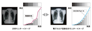 簡易DICOM モードを搭載