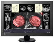 世界で初めてモノクロとカラー画像のハイブリッド表示を実現した医用画像表示モニター RadiForce RX430 新発売