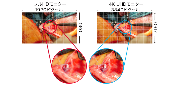 4K UHD解像度で手術映像を高精細に表示