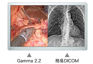 Gamma、DICOM