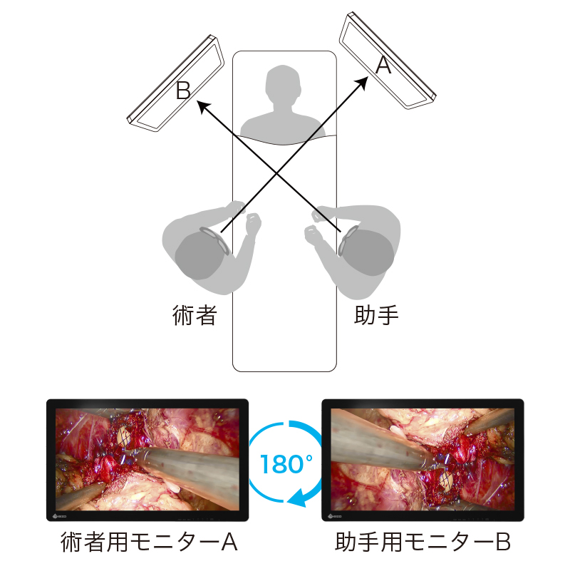 180度回転表示