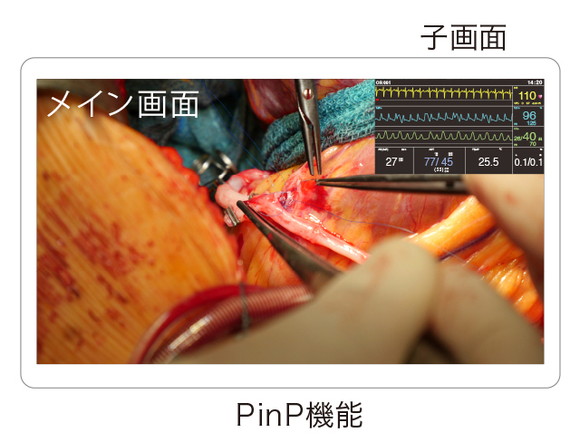 モニタリングに便利な2画面同時表示