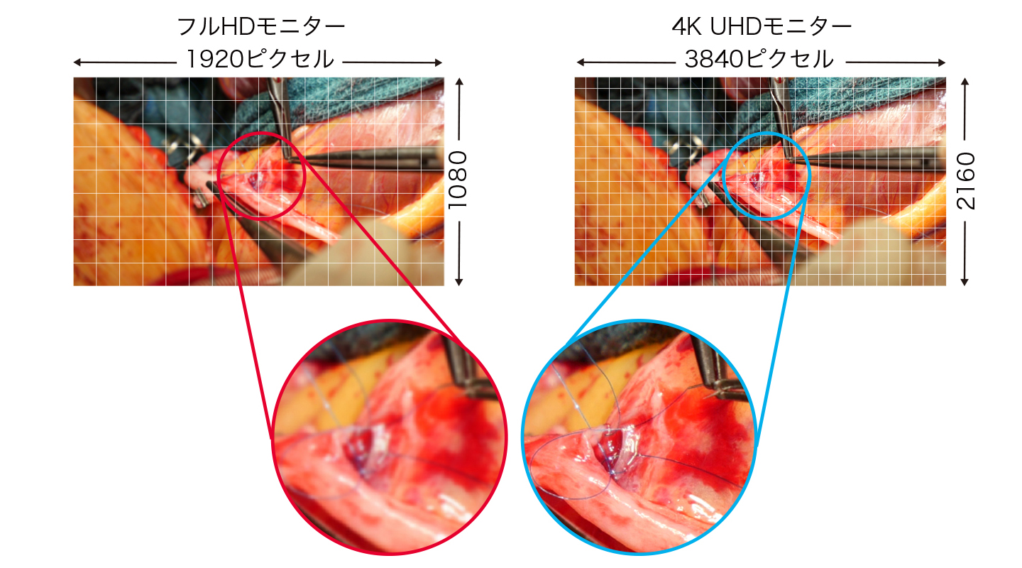 4K UHD解像度で手術映像を高輝度・高精細に表示