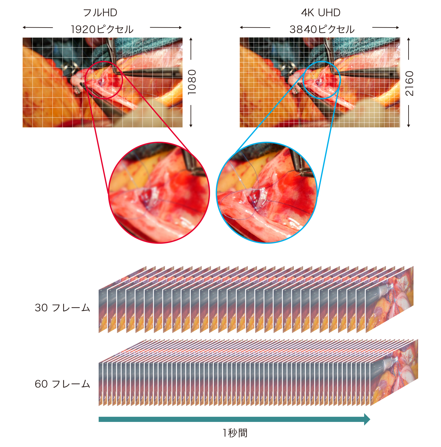 4K手術映像を高画質に記録