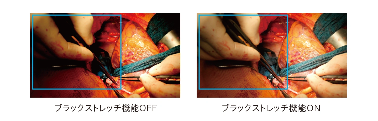 高画質撮影を実現