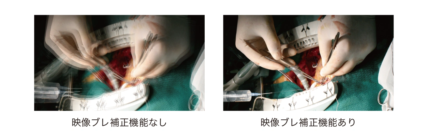 映像のブレ補正に対応