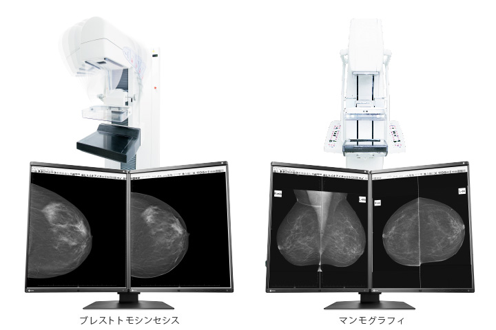 乳がん検査画像の表示に対応
