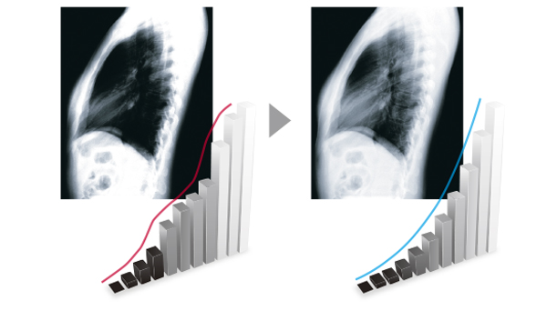 mx315w_dicom.jpg