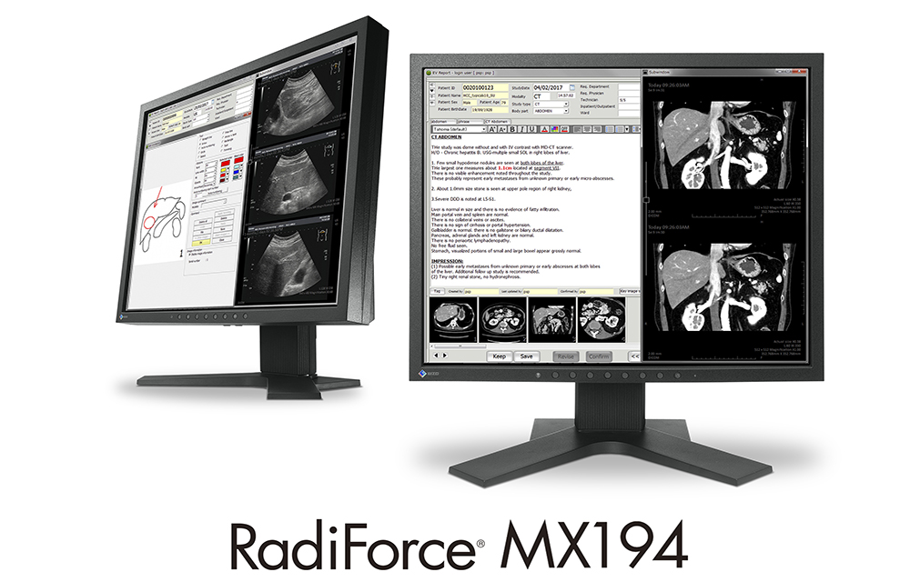 RadiForce MX194 | EIZO株式会社