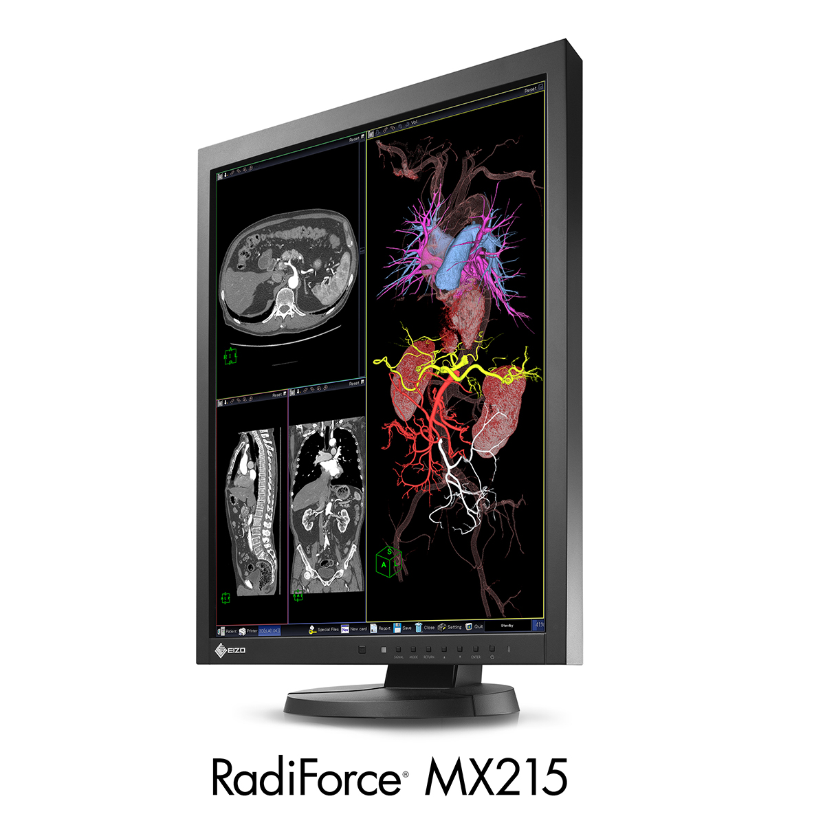 RadiForce MX215 | EIZO株式会社