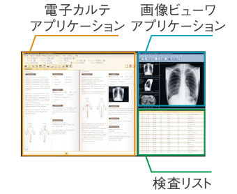 画面を使いやすく分割