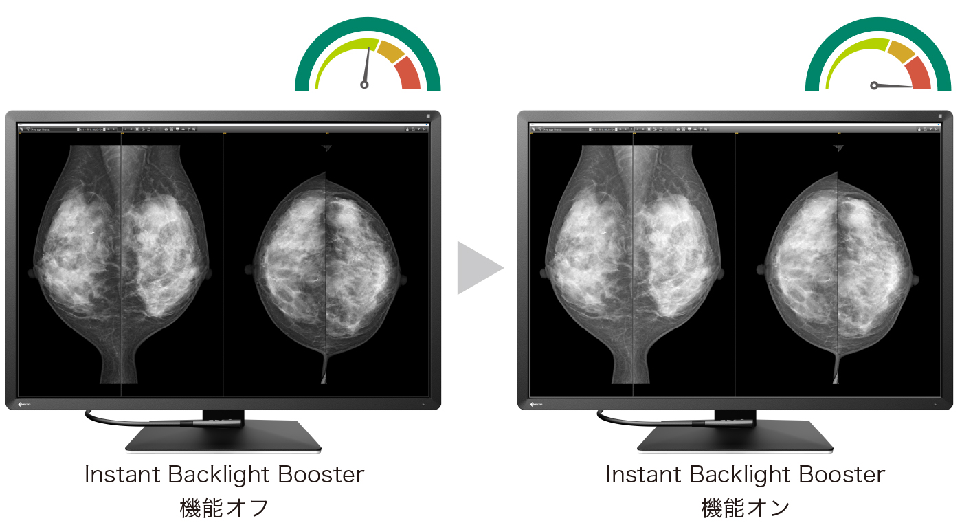 Instant Backlight Booster機能