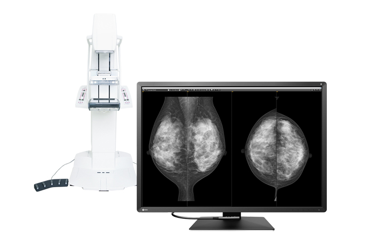 乳がん検査画像の表示に対応