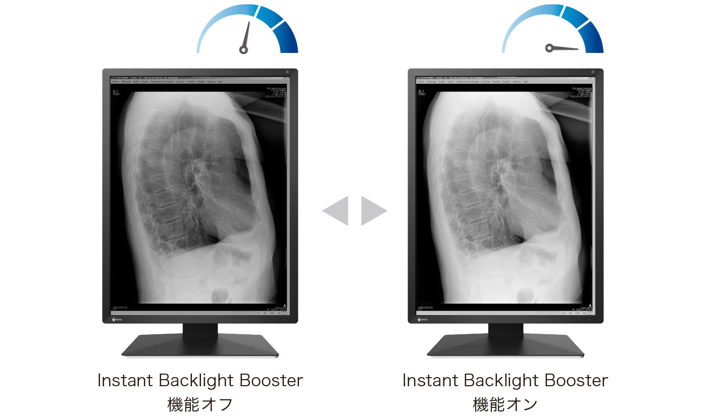 Instant Backlight Booster機能