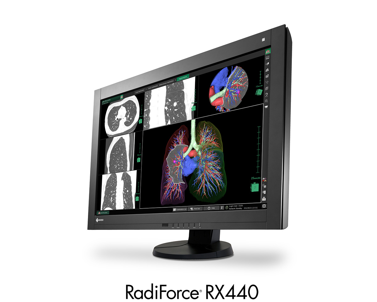 RadiForce RX440 | EIZO株式会社