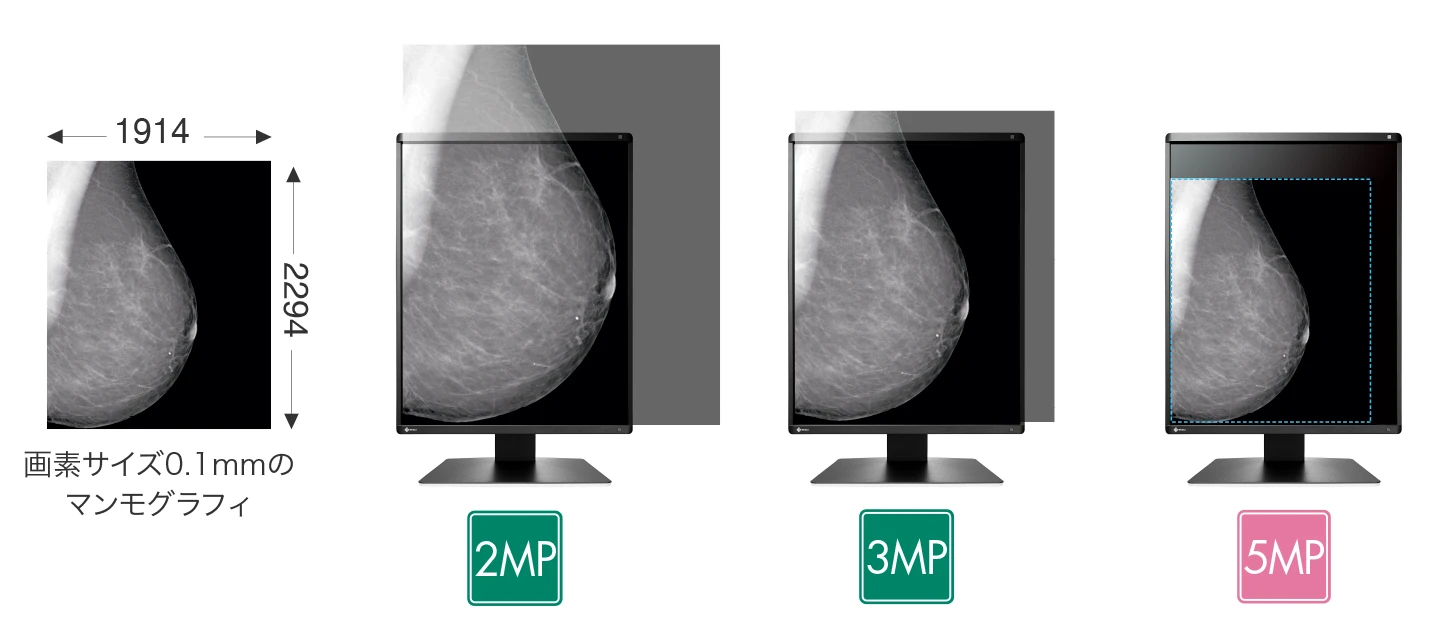 5MP