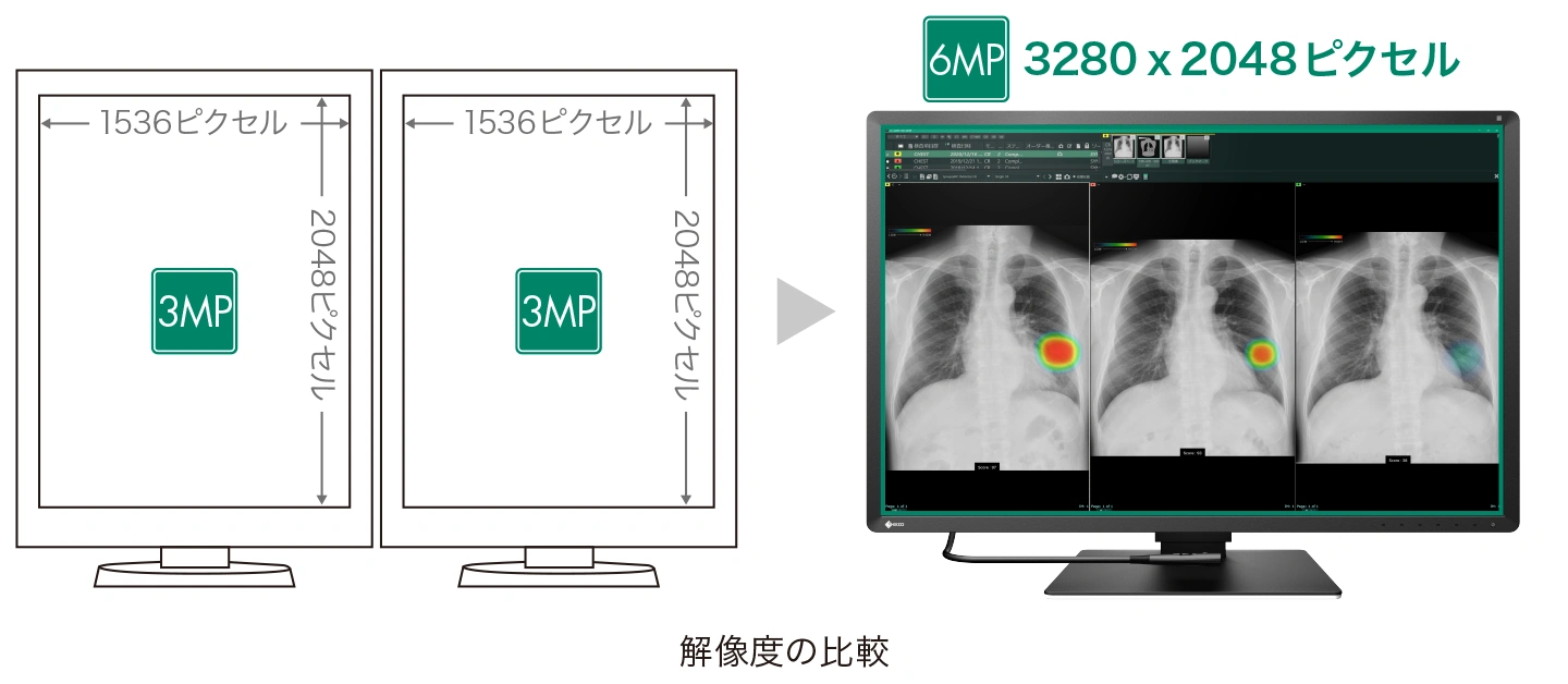 6MPの高解像度でマルチモダリティ対応